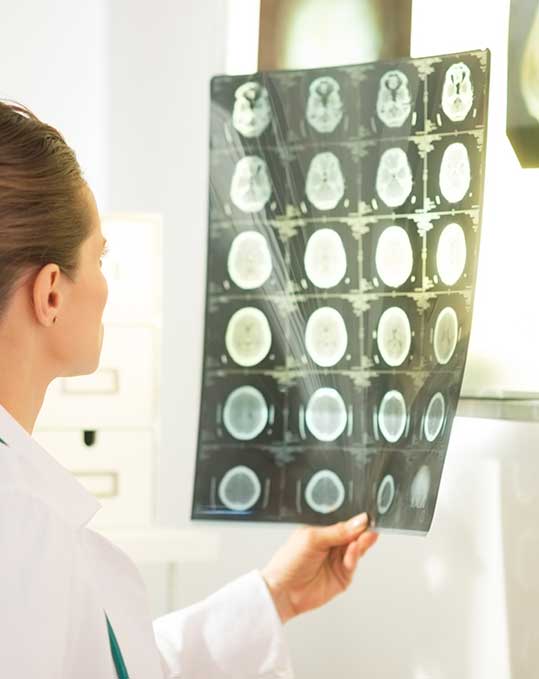 Brain Scan
